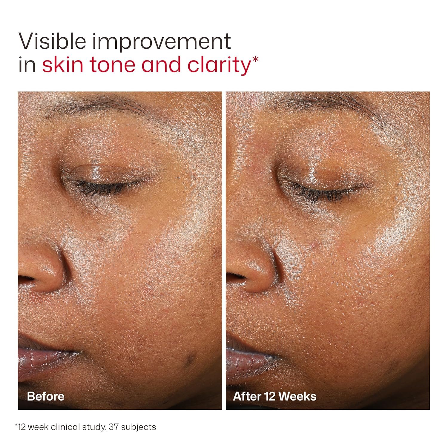 EltaMD UV Clear Tinted Face Sunscreen SPF 46, Oil Free Sunscreen for Sensitive Skin with Zinc Oxide, Dermatologist Recommended - Image 8